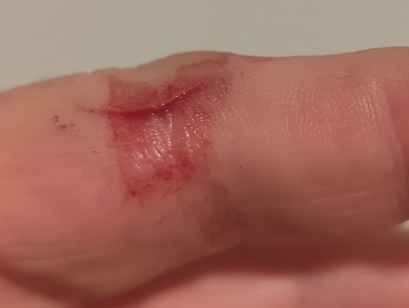 File:FingerSmall.jpg